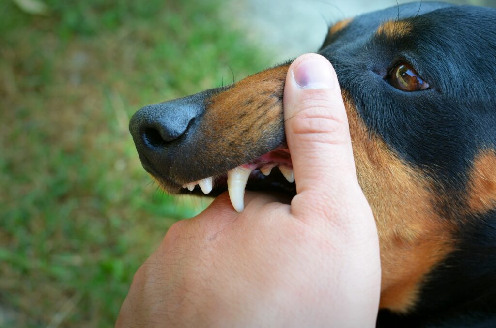 Best dog bite lawyer Calabasas